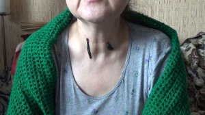 №3 Постановка Пиявок на щитовидную железу