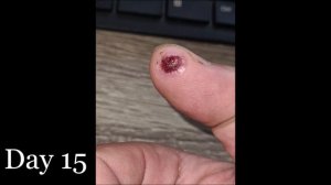 I sliced my finger open - healing time lapse