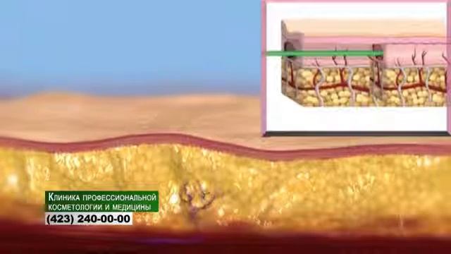 RF методика смотреть онлайн