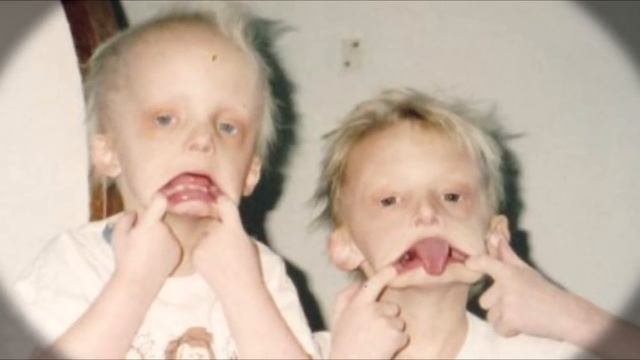 ВАМПИРЫ СУЩЕСТВУЮТ? СИНДРОМ ВАМПИРА!