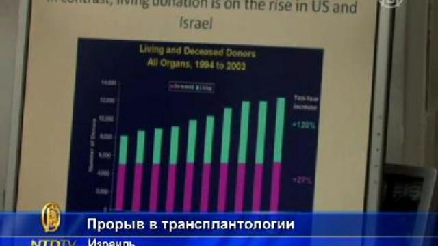 Израиль: революция в трансплантации почек  