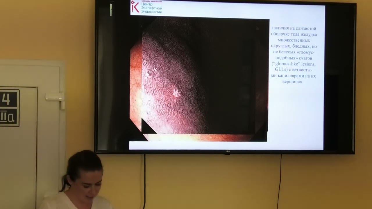 2024 08 17 02 Белова ЕВ Аутоиммунный атрофический гастрит