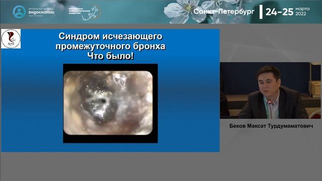 Сложные ситуации в диагностической и интервенционной бронхоскопи смотреть онлайн