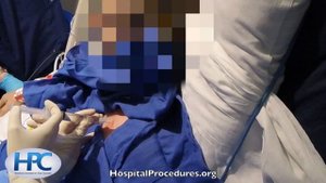 Pigtail catheter placement
