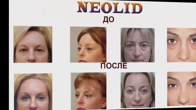 Как убрать мешки под глазами смотреть онлайн