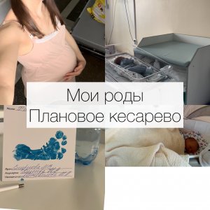 История моих родов _ Плановое кесарево сечение _ КС _