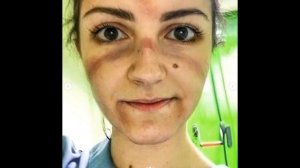 Реанимация