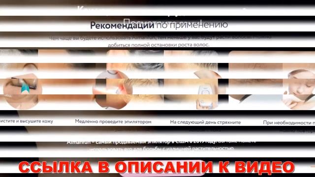 Какой лазерный эпилятор самый лучший