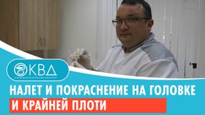 ? Налет и покраснение на головке и крайней плоти. Клинический случай №251
