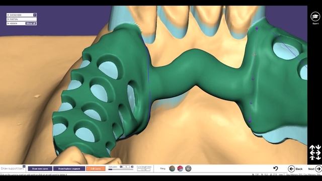 FREE FULL TUTORIAL - 2019 - Exocad-Partial lower jaw bar-design and support-bars смотреть онлайн