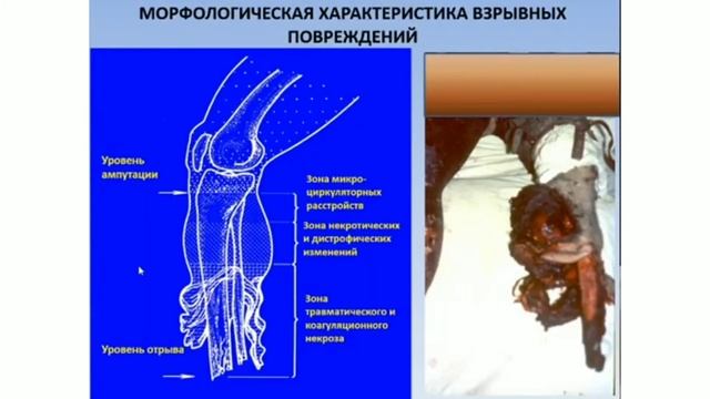 Классификация механических повреждения.