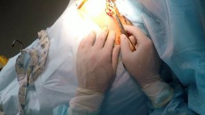 Сломал ключицу, что делать? Прооперировали