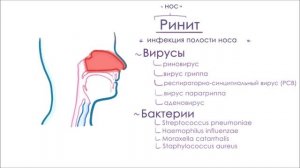Инфекции верхних дыхательных путей
