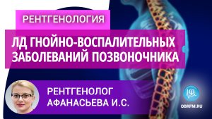 Рентгенолог Афанасьева И.С.: Луч-я ди-ка неспецифических гнойно-воспалительных заб-ний позвоночника