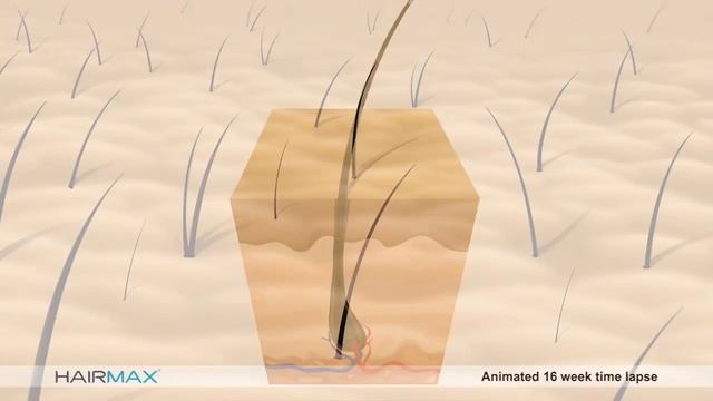 How HairMax works to Regrow Your Hair смотреть онлайн