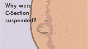 Pregnant belly button