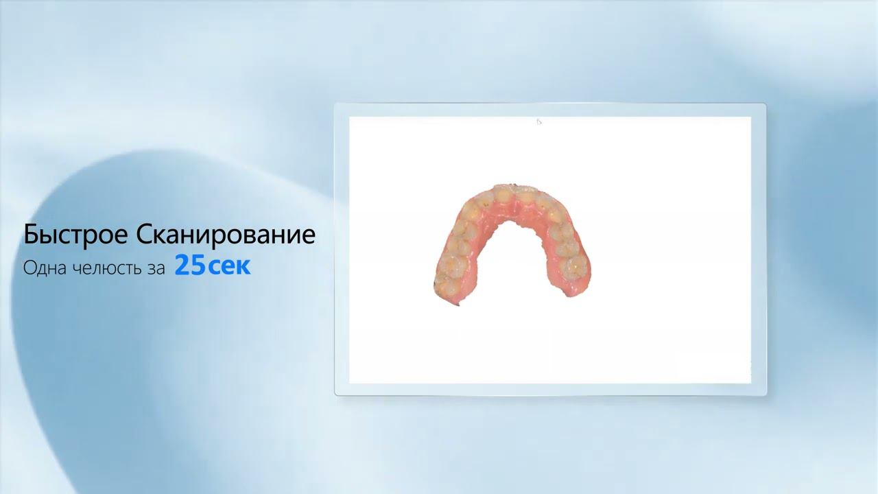 Shining 3D Aoralscan 3   цифровой интраоральный сканер для стоматологов