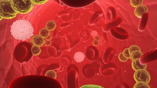 Когато влагалищната микросреда страда смотреть онлайн