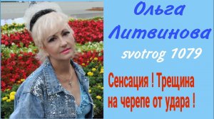 Перевал Дятлова. Ольга Литвинова. Трещина на черепе Семена Золотарёва от удара.