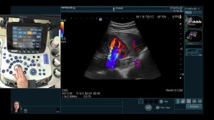 Мастер-класс по почечным артериям от профессора Гажоновой В.Е.  от 19.12.2020