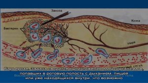 Анатомия и функциональные особенности миндалин