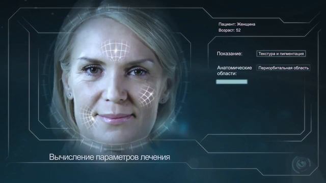 Лазерная косметология в Минске. CO2-лазер Lumenis AcuPulse