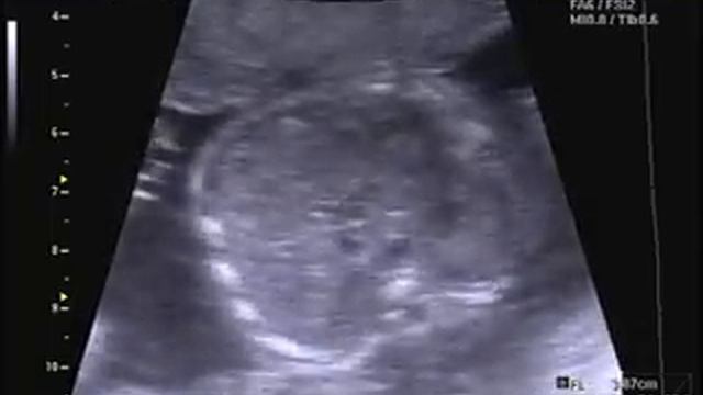 УЗИ 21 неделя..наш мальчик)) смотреть онлайн
