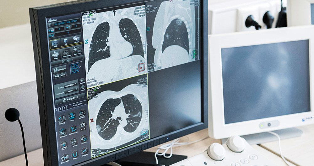 В Москве ИИ начал определять увеличение лимфатических узлов на КТ / Город новостей на ТВЦ