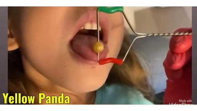 Зонд массажный с бусиной для миогимнастики