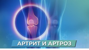 АРТРИТ и АРТРОЗ! Как вылечить артроз без лекарств?