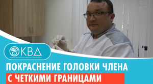 ? Покраснение головки члена с четкими границами. Клинический случай №659