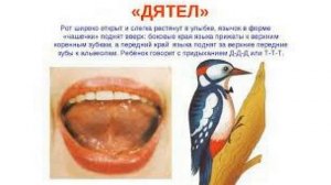 Артикуляционное упражнение Дятел. Упражнение Дятел как сделать правильно? Детский логопед.