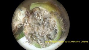 Где Живут Тополевые Галловые Тли? Спиралевые Тли Pemphigus spyrothecae Под Микроскопом. Удивительно