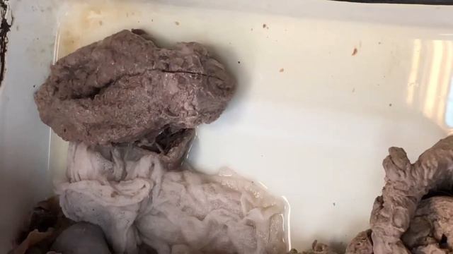 Мочеточник и мочевой пузырь