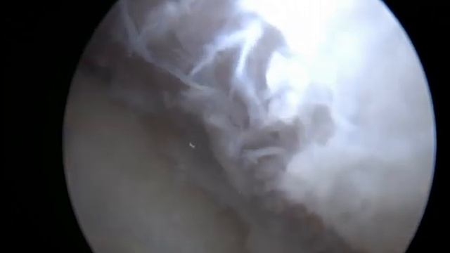 РОХ через 5 лет болезни у собак Артроскопия смотреть онлайн