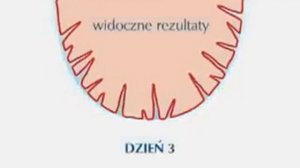 Scholl Cracked Heel Repair Cream  2