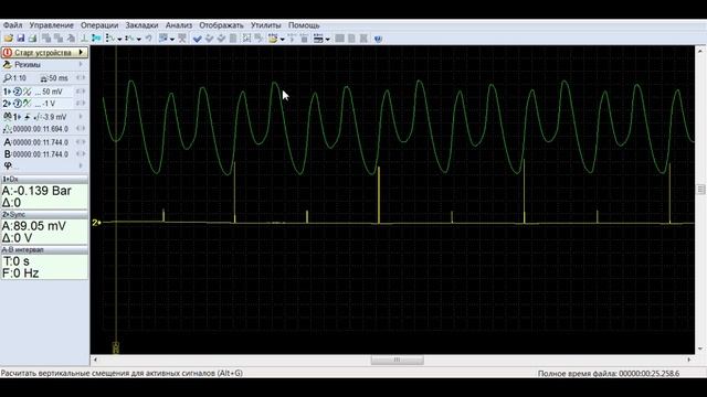Из за чего троит Гранта? Пять минут и все понятно! смотреть онлайн