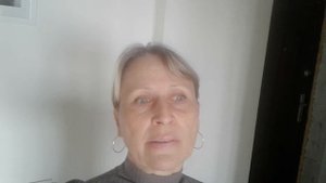 12. Имплантация/ Уже месяц, как установили имплант заново/ Мое состояние.