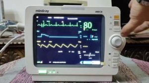 Monitor Multiparametros Imec 8