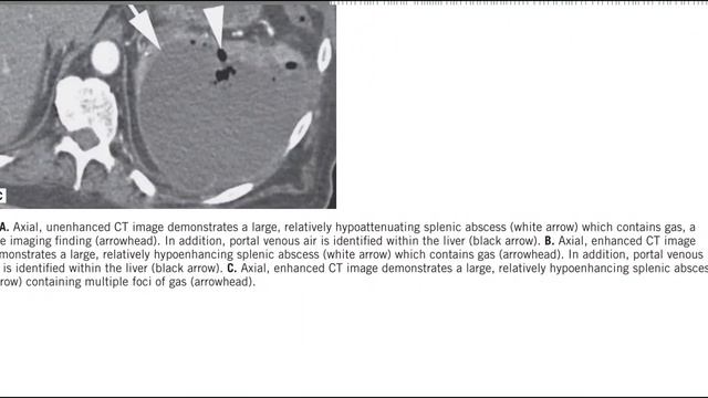 MC GRAW HILL GIT RADIOLOGY BOOKS FRCR(2) смотреть онлайн