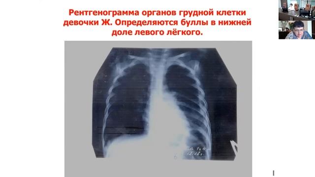 Школа клинического мышления педиатра. смотреть онлайн