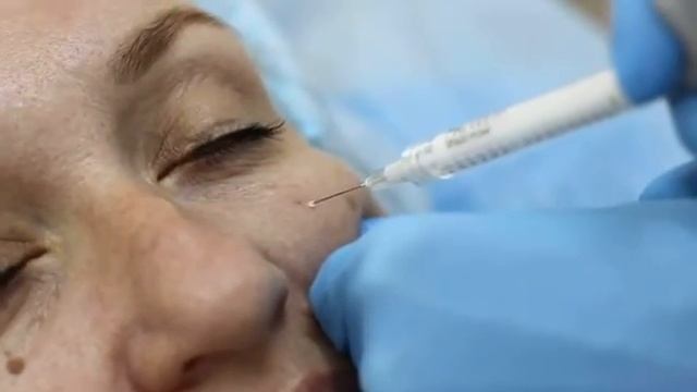 ? Акция на Facetem в июле! смотреть онлайн