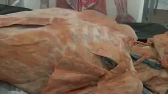 Анатомия. Мышцы туловища