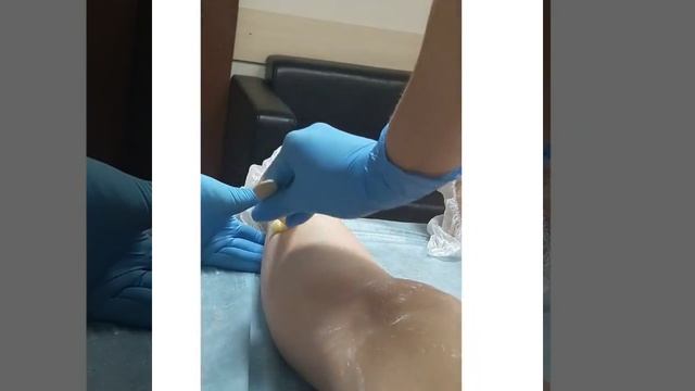 Центр подготовки специалистов по шугарингу "Epilnice" смотреть онлайн