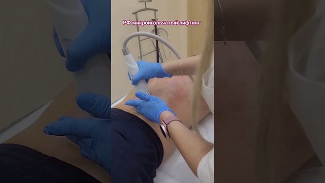 Постакне часто локализуются на спине, зоне декольте на подбородке, щеках и лбу.#спб#красота#питер