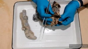 Полость рта  губы, щеки, десна, нёбо, дно полости рта, пространства дна полости