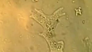 Амебоидное движение