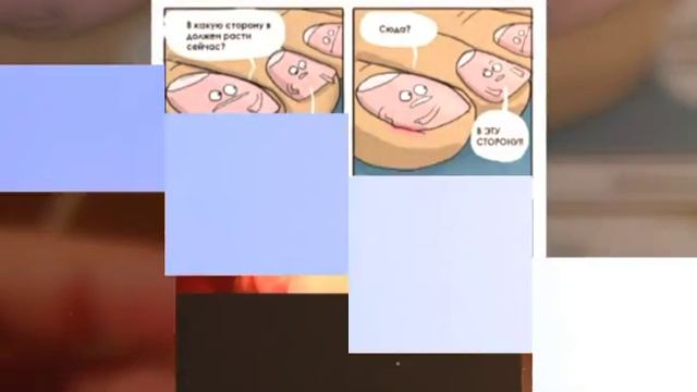 Что будет если подстригать ногти под корень!!! смотреть онлайн