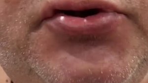 Вставляю зубы