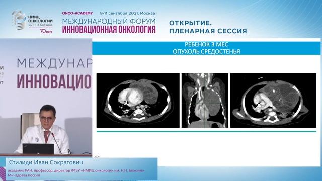 Что такое онкохирургия сегодня? смотреть онлайн